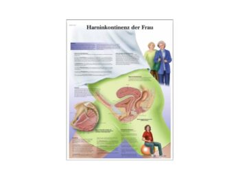 Lehrtafel - Harninkontinenz der Frau