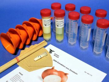 DNA-Extraktion aus der Zwiebel