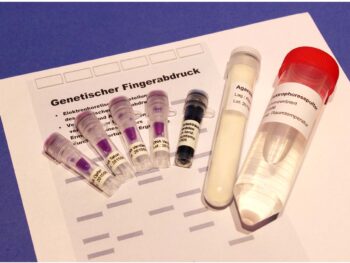 Genetischer Fingerabdruck (DNA-Fingerprint)